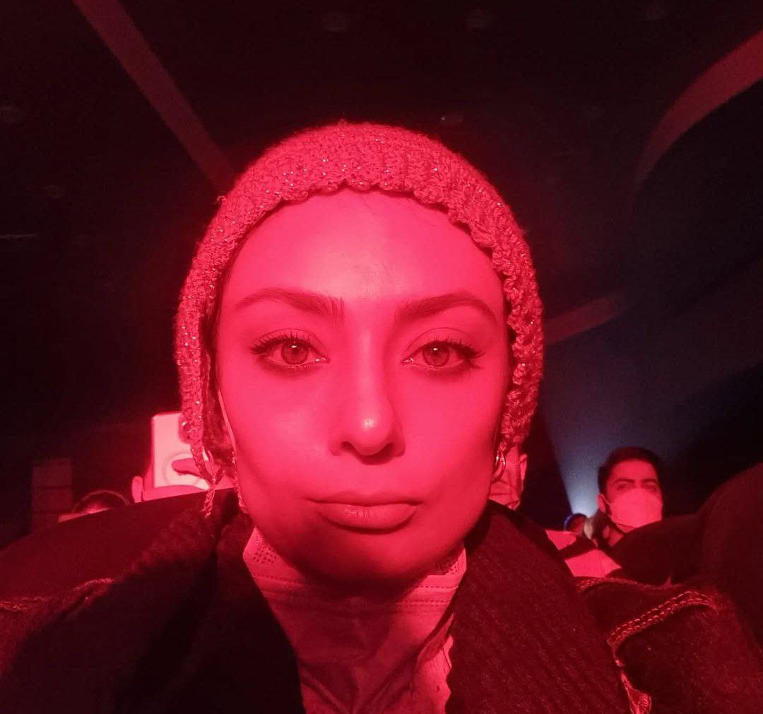 عکس یکتا ناصر قبل از عمل  عکس یکتا ناصر قبل از عمل