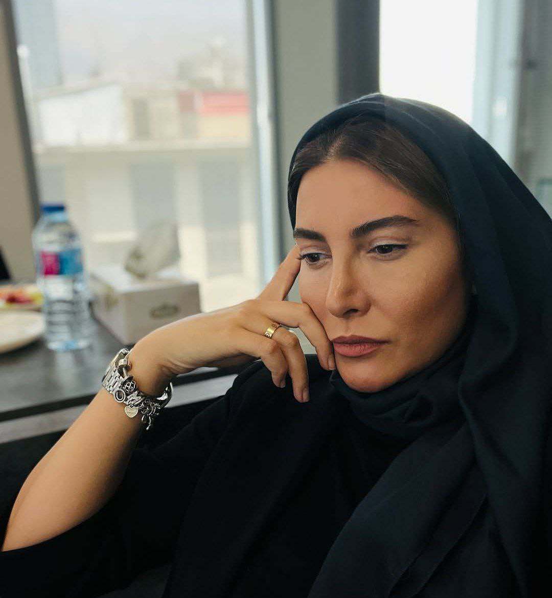 عکس فریبا نادری بعد از عمل زیبایی