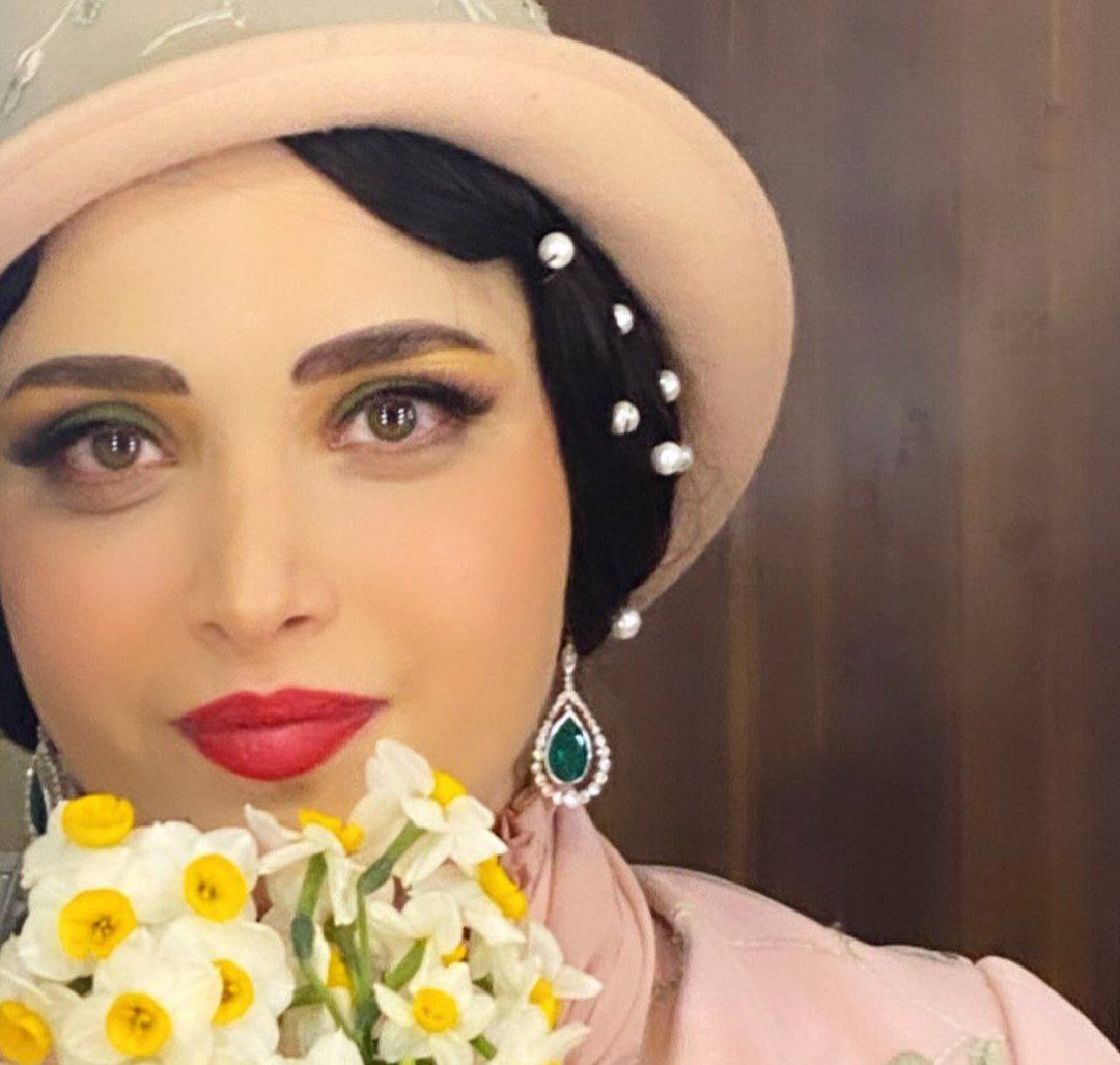 بهنوش طباطبایی بعد از عمل زیبایی