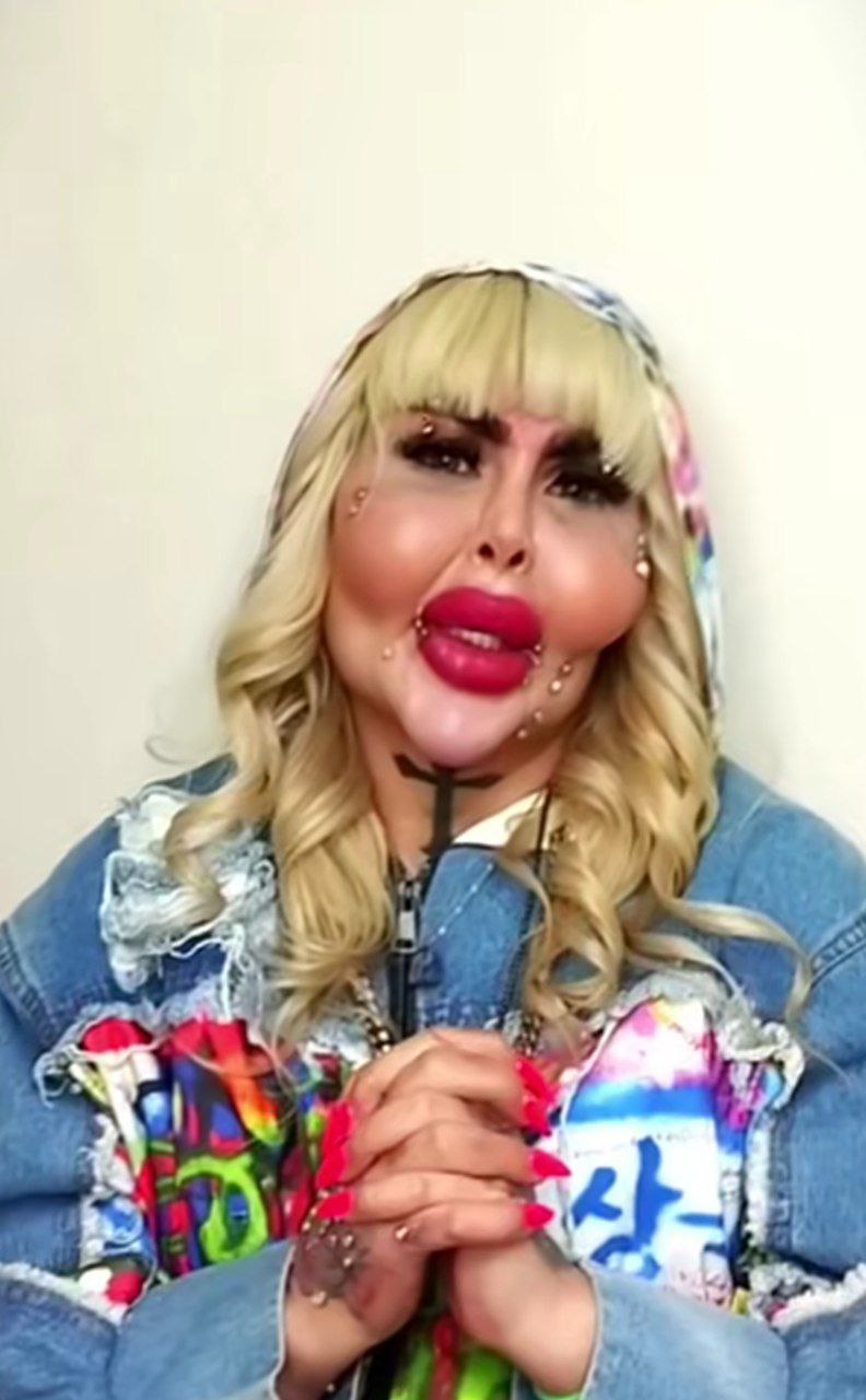 عکس قبل آناهیتا ناچو 